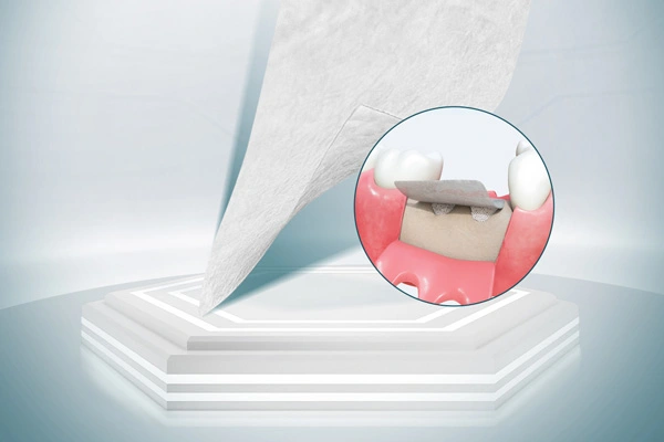 مواد جراحة الأسنان