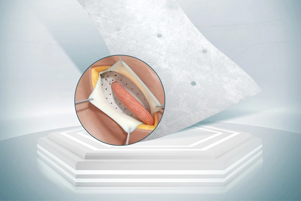 منتجات SIS البيولوجية للجراحة العامة