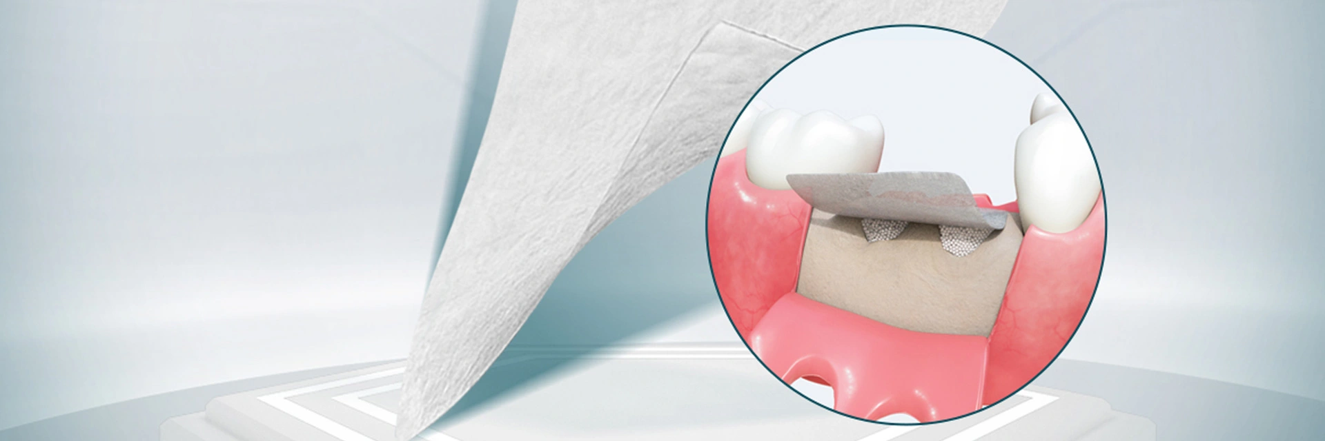 مواد جراحة الأسنان