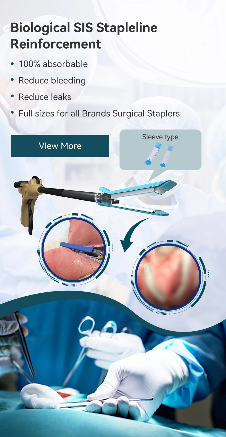 تقوية شضفيرة سيس البيولوجية