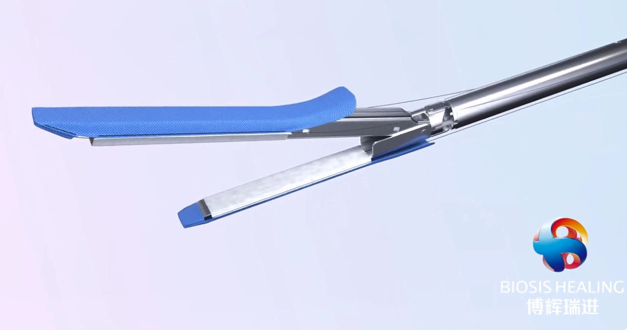 تعزيز خط التيجان لاستئصال المعدة الأكمام لجراحة السمنة