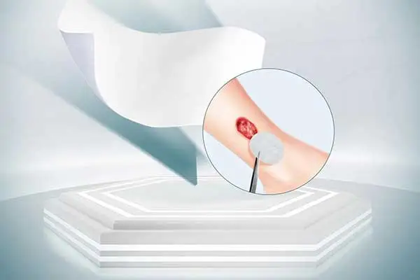 منتجات إدارة الجروح