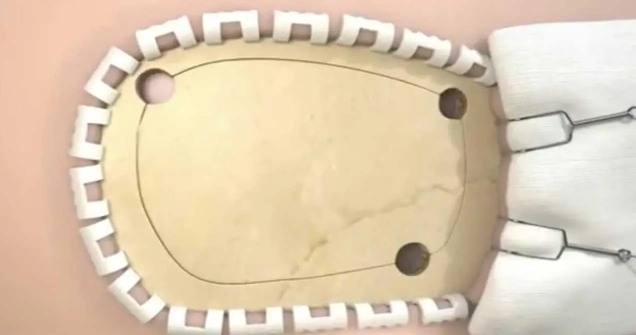 رقعة إصلاح جدارية