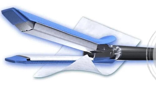 تفسير إجماع-إجماع الخبراء على استراتيجيات إدارة تسرب الهواء الرئوي المستمر أثناء جراحة الصدر حول الجراحة وفوائد سريرية لخنازير صغيرة غير مترابطة داخل المخاطية المعوية (SIS) مصفوفة خارج الخلية