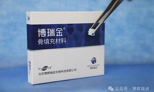 منتجات مواد زراعة العظام التي تم الحصول عليها رسميًا من Vidasis ، وقد رحبت عائلة الفم للشفاء الحيوي بآخر