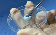 مواد تطعيم العظام